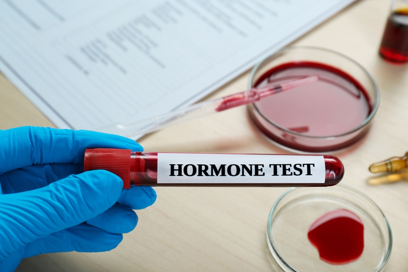 Frequently Asked Questions: What Is Hormone Testing?