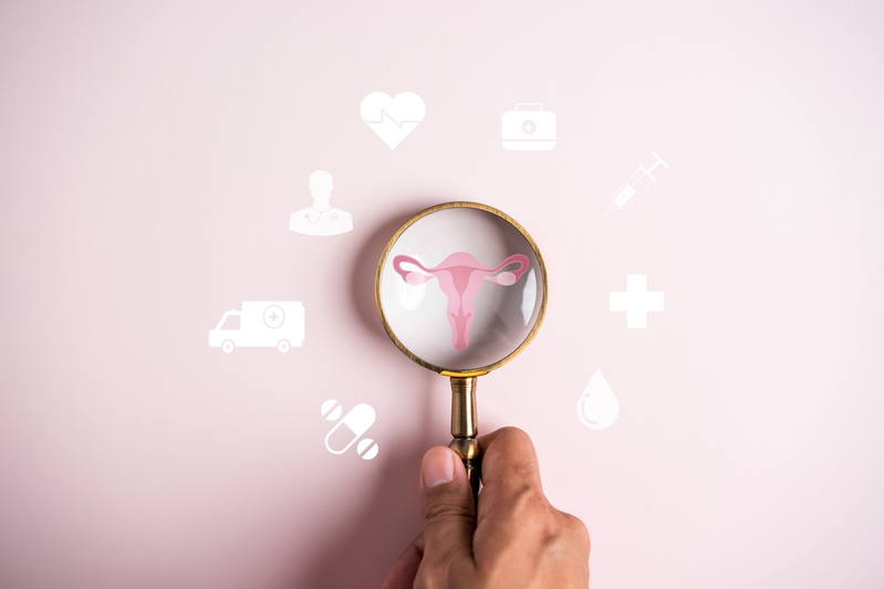 Managing PCOS Naturally: Our 5 Best Tips