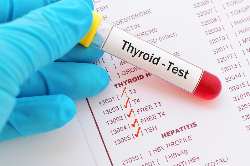 What You Need to Know About Thyroid Hormone Testing