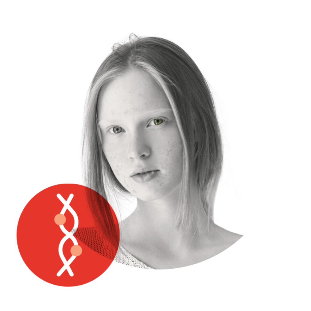 GX- AcneTest Genetic Analysis